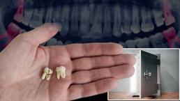 20'lik dişlerini bankada saklayan var! Tamir çipi devrede: 'Türkiye de adım attı'