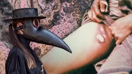 Kara Veba döndü mü? İnsandan insana bulaş net şekilde tarihe geçti: 'Öksürük yetiyor'