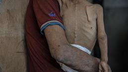 BM'den Gazze için bir uyarı daha: Çocuklar açlıktan eriyor