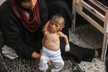 Gazze’de sessiz katliam: Bebekler açlıktan can veriyor!