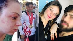 Dilan'ın kabus evliliği! Milli sporcu eşini şikayet etti: Gereksiz sebeplerle dayak yiyordum
