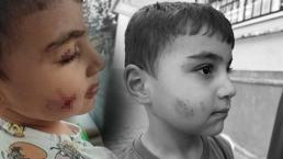 Ankara'da kan donduran olay! Evde uyuyan çocuğu lağım faresi ısırdı