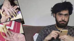 Hatay’da şoke eden hikaye! 3 yıldır evden çıkmıyor, banyo yapmıyor, sadece telefon ve bilgisayarla yaşıyor