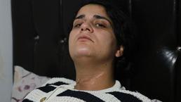 Cips paketini açarken boğazını kesti! Ayrıldığı eşi dehşeti yaşattı: Ölmedin mi sen?