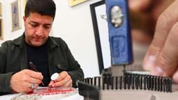 Türkiye'deki 8 kişiden biri! ‘Osmanlı'dan geldiği düşünülüyor’