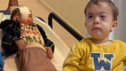 Fırında torpil skandalı! 2 yaşındaki çocuğu kör etti: '1 hafta önce satmasın diye yalvarmıştım'