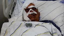 Kentte 5'inci ayı dehşeti! Hayvan otlatırken saldırdı: 'Yüzünde çok büyük kesiler, yırtıklar vardı'