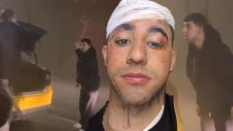 İstanbul'da taksici dehşeti! 'Sopayla kafama 10 defa vurdu'