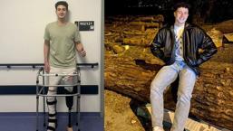 Bacağını kaybeden üniversiteli genç 7 ay sonra ayağa kalktı: Milli takımda olmayı çok isterim