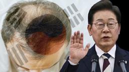 Güney Kore liderinden kelliğe savaş! Oy için miydi?