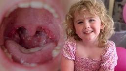 Bademcik ameliyatı 5 yaşındaki kızı hayattan kopardı! Ölümün ardındaki 'tek gece' detayı