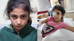 8 yaşındaki Şeyma’yı kör eden gözlük! Aile şaşkına döndü: ‘Kızımın geleceği gitti’