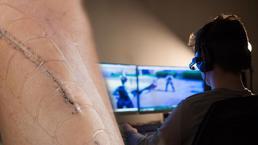 Diz ameliyatından çıktı ana dilini unuttu: Kendini ABD'de sandı! Peki sebebi oyunlar mı?