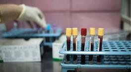 Vücutta kansere doğal kalkan! 25 yıllık takip sonuç verdi: İlaca gerek kalmayacak mı?