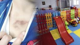 İBB kreşinde istismar ve darp iddiası! Sevk yazısı ortaya çıktı