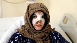 Eşinin kaldırım taşı ile dövdüğü Nazlı: Ayaklarım üzerinde dursaydım o adama dönmezdim