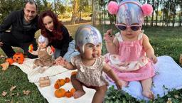 Doğumda öğrendikleri teşhis hayatlarını değiştirdi!