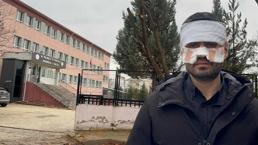 Okulda dehşete düşüren olay! Rehber öğretmen, Fizik öğretmenini kaynar çayla haşladı