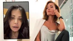 Didem Ceran'dan şoke eden paylaşım: Yüzü nakledilen kişinin alnı kaşıma denk geldi!