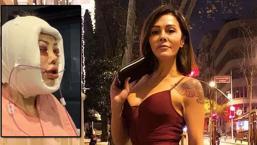 Yüz nakli yaptırmıştı! Didem Ceran’ın inanılmaz değişimi