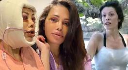 Yüz nakli olan Didem Ceran son halini paylaştı! ‘Bebeksiliğim yapay zeka değil’