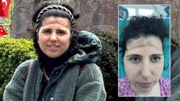 3 boyutlu teknoloji mucizesi! Alnındaki çöküklük tarih oldu