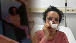 Eşi tarafından burnu ısırılıp koparılan İmran dehşeti anlattı: Acıyla balkondan atlamayı düşündüm