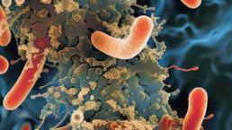 Peynirde Listeria alarmı
