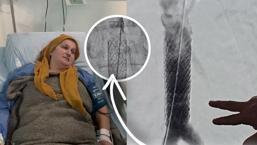 'Milyonda bir': Öksürürken kalp damarı yırtıldı