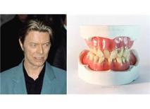 David Bowie'nin Dişleri Kendisi Gibi Farklıydı