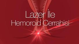 Lazer ile hemoroid cerrahisi