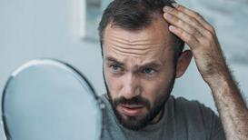 Saç dökülmesi psikolojinizi etkileyebilir!