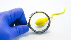 Sperm seçiminde mikrofludik “çip” kullanımı