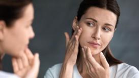 Yağlı ve sivilceli cilde sahip olanlar için 10 madde ile en etkili cilt bakım tavsiyeleri