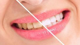 Dişlerinizi sarı veya solgun yapan nedir?