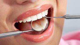 Sağlıklı diş etleri için rehber bilgiler