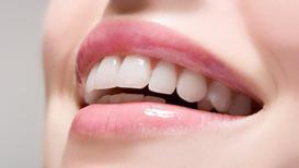 Estetik diş hekimliğinde lamine neden sıklıkla tercih ediliyor?