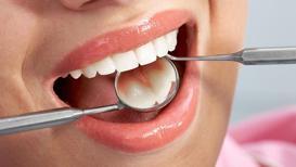Gülüş tasarımı ortodontik tedavi gerektirir mi?