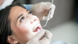 Diş taşı temizliği için 6 neden