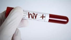 HIV + Ayrımcılığı ve Çalışma Hayatı