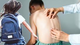 Çocuklarda omurga sağlığını tehdit eden tehlike! 'Yanlış yapılırsa yaşlılıkta bile etkiler'