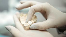 Diş eksikliğinde implant şart mı?