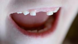 Çocuklarda diş çürükleri ve korunma yolları