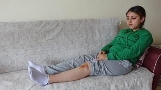 Liseli Özge, köpeklerin saldırısında yaralandı