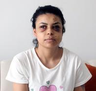 Düşüncesizce ateş açıldı, penceredeki genç kız yaralandı