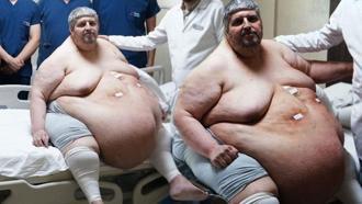 310 kiloya ulaştı! “Ölmek için dua ettim” dedi, yıllar sonra ilk adım