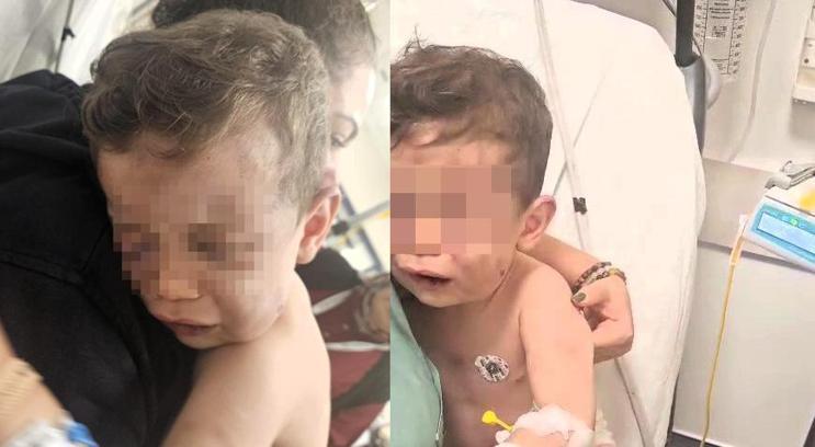 2 yaşındaki bebek annesinin erkek arkadaşı tarafından öldüresiye dövüldü