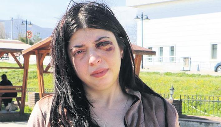 Tacizin bıraktığı yara: Platinler