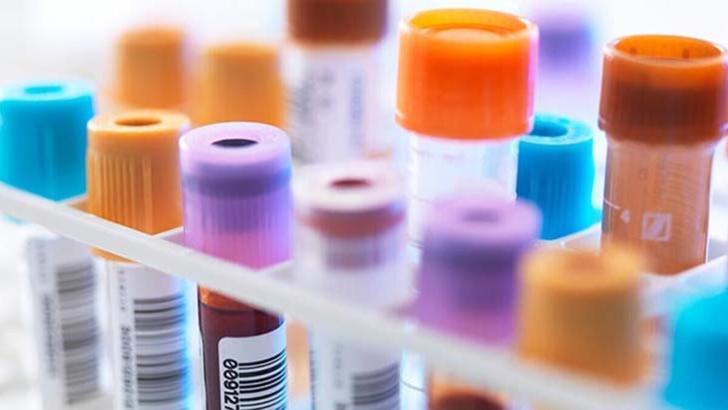Hemogram nedir, testi nasıl yapılır? Hemogram tahlili sonuçları ne zaman çıkar?