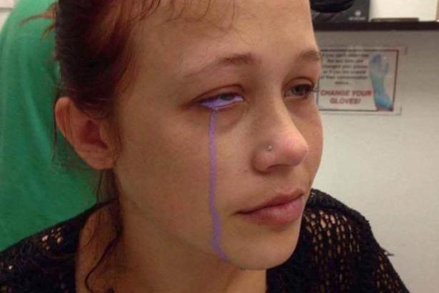 Göz dövmesi yaptıran kadının mor gözyaşları!